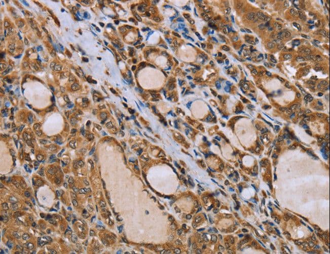 IKBKE / IKKI / IKKE Antibody