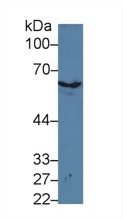 KRT2 / CK2 / Cytokeratin 2 Antibody (aa200-508)