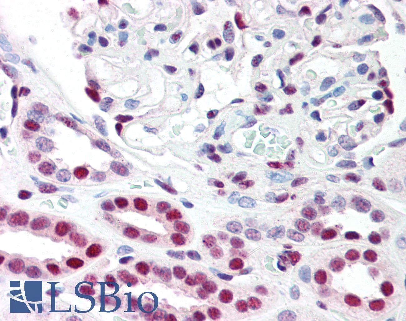 IHC-plus™ TP53BP1 / 53BP1 Antibody