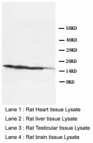 Ly6a / Sca-1 Antibody (aa91-108, Magnetic beads)