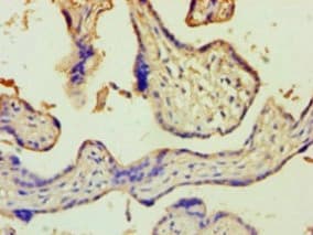 ZRANB2 / ZNF265 Antibody