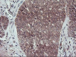 FMR1 / FMRP Antibody (clone OTI2C3)