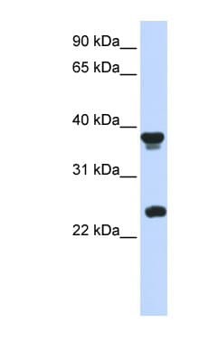 Polyclonal Rabbit anti-Human ATOH1 / MATH-1 Antibody (C-Terminus, IHC, WB)