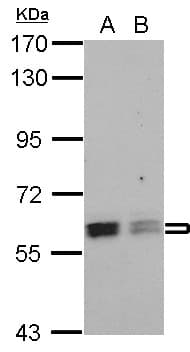 Polyclonal Rabbit anti-Human PTBP3 / ROD1 Antibody (WB)