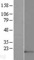 Human C21orf34 Protein (Over-Expression Lysate Myc-DDK (Flag))