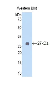 FBN2 / Fibrillin 2 Antibody (aa896-1106)