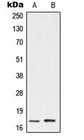 Polyclonal Rabbit anti-Human UBE2A+B Antibody (C-Terminus, WB)