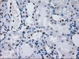 PSMA7 Antibody (clone OTI8F9)