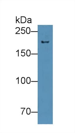 NUP210 / gp210 Antibody (aa1149-1295)
