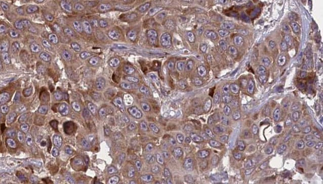 MME / CD10 Antibody