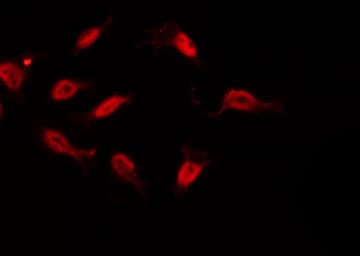 TAF6L Antibody