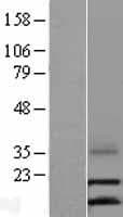 Human CCL16 / LEC Protein (Over-Expression Lysate Myc-DDK (Flag))