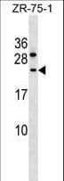 CCDC140 Antibody (aa31-60)