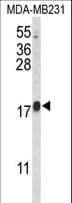 CBY1 / PGEA1 Antibody (aa98-126)