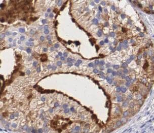 VCL / Vinculin Antibody