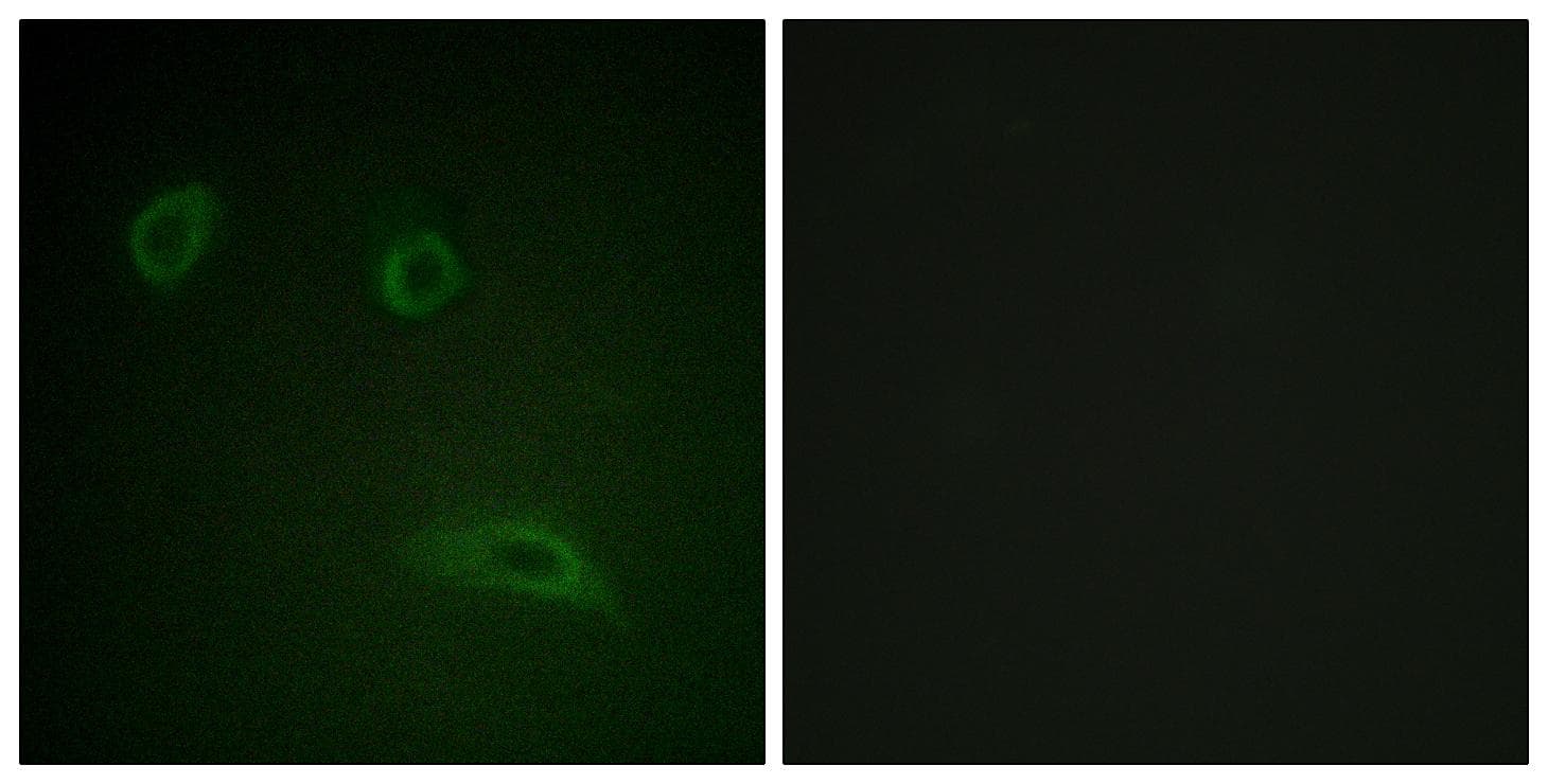 ERBB2 / HER2 Antibody