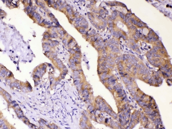 AMD / AMD1 Antibody