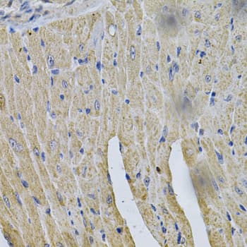 HMG-CoA Reductase / HMGCR Antibody