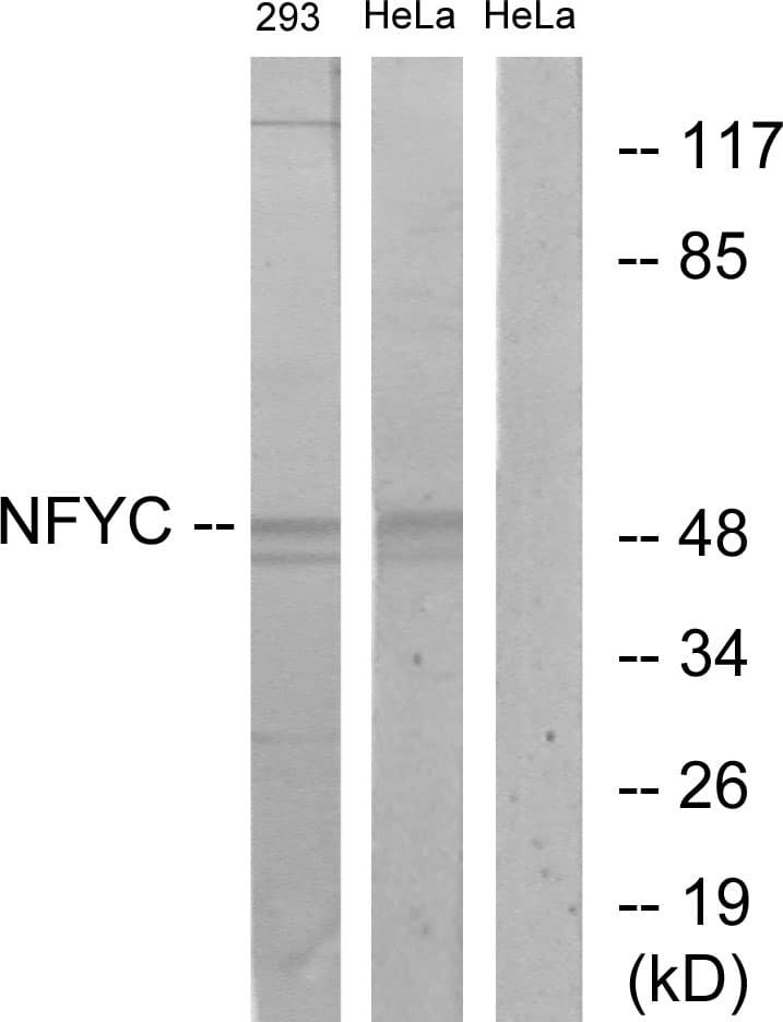 NFYC Antibody (aa1-50)