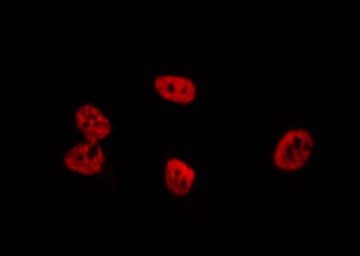RENT1 / UPF1 Antibody