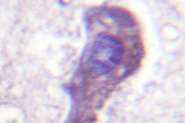 Polyclonal Rabbit anti-Human Tuberin / TSC2 Antibody (Leu1456, IHC)