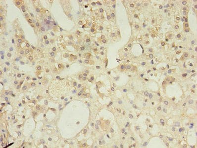 MSH6 Antibody (aa1-400)