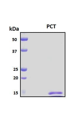 Human CALCA Protein (Recombinant His, N-Terminal)