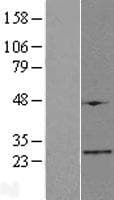 FAM173B Protein (Over-Expression Lysate Myc-DDK (Flag))