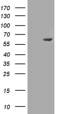 ESR2 / ER Beta Antibody (aa1-260, clone OTI1A5)