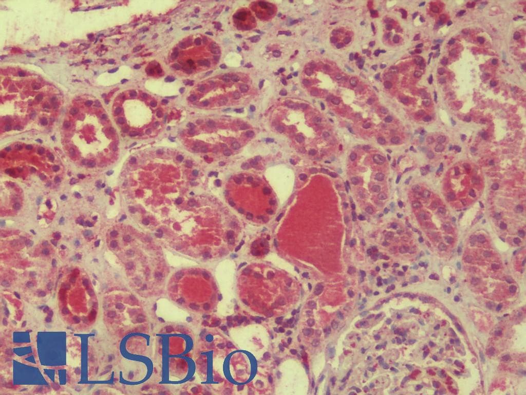 IHC-plus™ Polyclonal Rabbit anti-Human DDA1 Antibody (IHC, IF, WB)