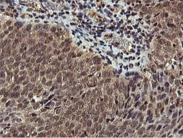 AKT1 Antibody (clone OTI3E3)