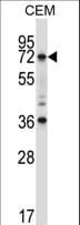 RORC / ROR Gamma Antibody (aa187-216)
