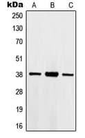 HOXB2 Antibody (Internal)