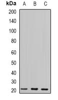 Polyclonal Rabbit anti-Human GLO1 / Glyoxalase I Antibody (IHC, WB)