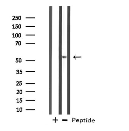 Polyclonal Rabbit anti-Human DDX19B Antibody (IF, WB)