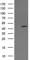 CATIP / C2orf62 Antibody (clone OTI3F11)