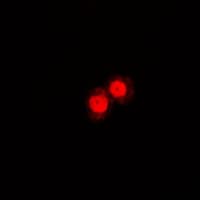 IHC-plus™ Polyclonal Rabbit anti-Human ANXA1 / Annexin A1 Antibody (Internal, IHC, IF, WB)