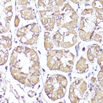 OPRK1 / Kappa Opioid Receptor Antibody