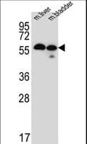 Polyclonal Rabbit anti-Human TMEM87B Antibody (aa484-513, WB)
