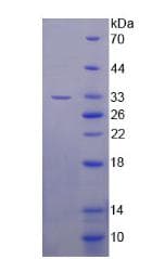 Human BCL11A Protein (Recombinant His-T7)