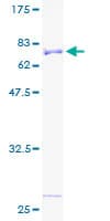 Human STK32B Protein (Recombinant GST)