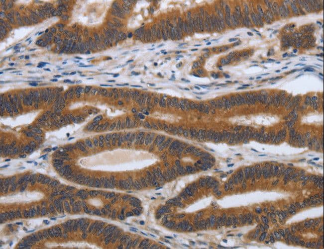 Polyclonal Rabbit anti-Human PDGF-AA Antibody (IHC)
