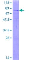 Human METTL4 Protein (Recombinant GST)