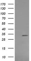 RARRES1 Antibody (clone OTI1A7)