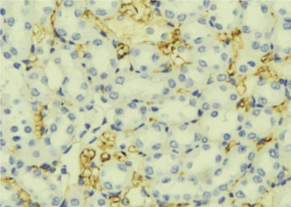 Polyclonal Rabbit anti-Human UGT1A9 Antibody (IHC, WB)