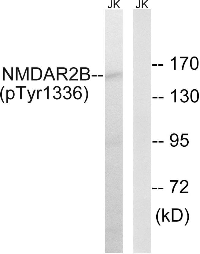 GRIN2B / NMDAR2B / NR2B Antibody (phospho-Tyr1336)