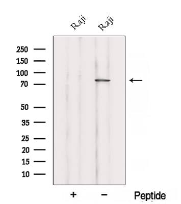 ABCB6 Antibody