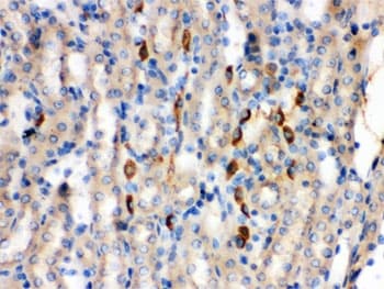 Polyclonal Rabbit anti-Mouse KNG1 / Kininogen / Bradykinin Antibody (IHC, WB)