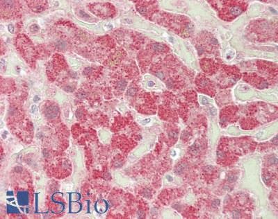 IHC-plus™ SULT1A1 / Sulfotransferase 1A1 Antibody