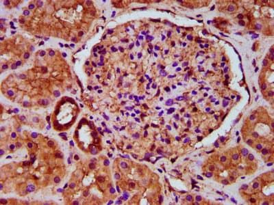 TBC1 / TBC1D1 Antibody